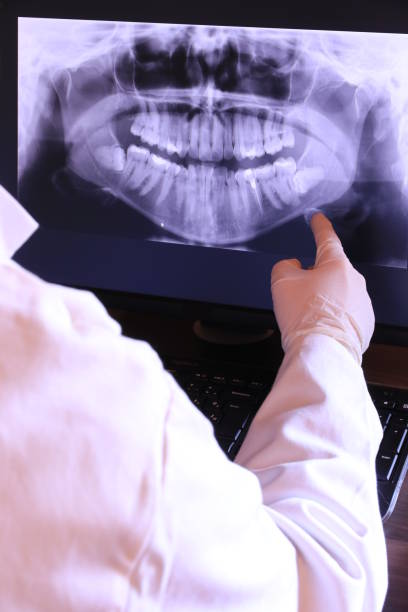 Best Emergency Dental Care for Broken or Chipped Teeth in Milford Square, PA
